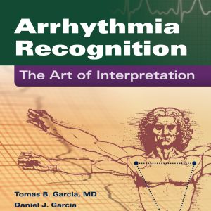 Arrhythmia Recognition The Art of Interpretation 2nd Edition