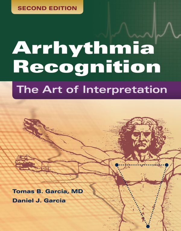 Arrhythmia Recognition The Art of Interpretation 2nd Edition