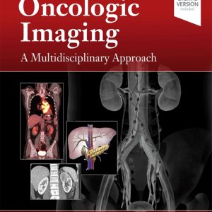 Oncologic Imaging A Multidisciplinary Approach 2nd Edition