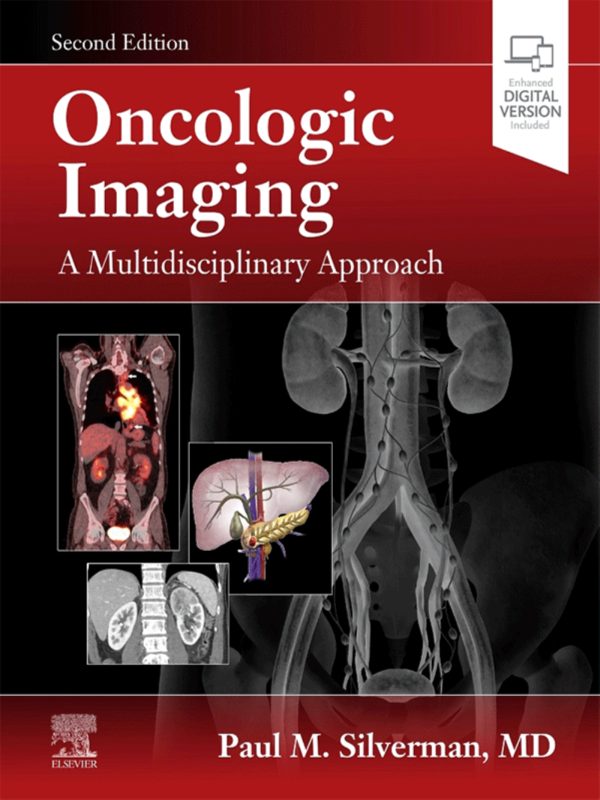 Oncologic Imaging A Multidisciplinary Approach 2nd Edition