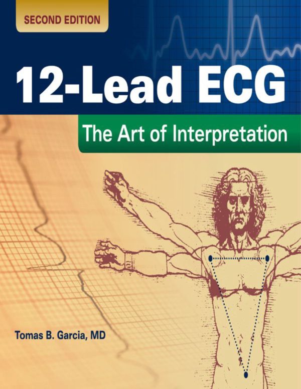 12-Lead ECG The Art Of Interpretation 2nd Edition