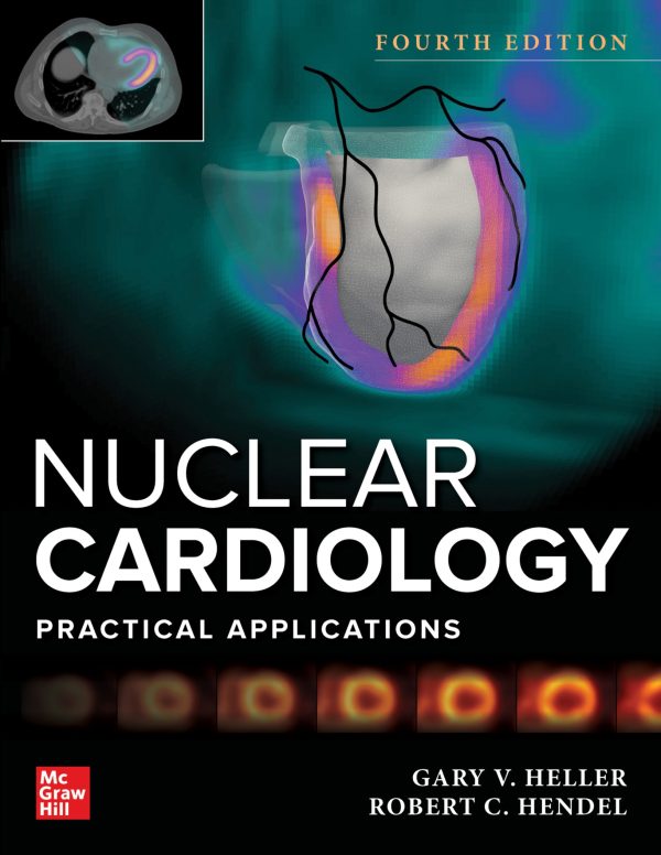 Nuclear Cardiology Practical Applications 4th Edition
