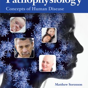 Pathophysiology Concepts of Human Disease