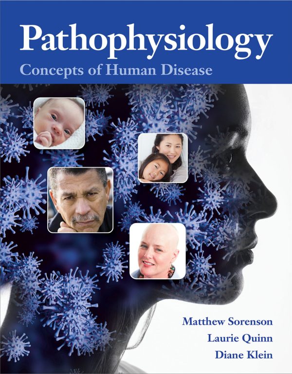 Pathophysiology Concepts of Human Disease
